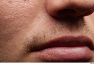 HD Face Skin darren cheek face lips mouth nose skin…